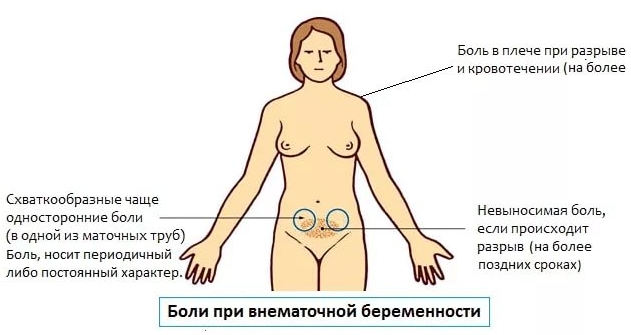 Причины боли внизу живота при беременности на ранних сроках