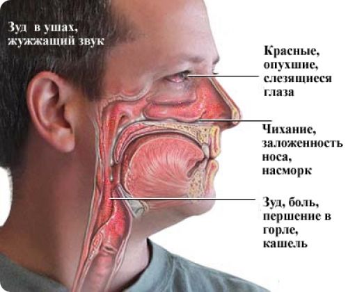 Как распознать аллергический насморк?