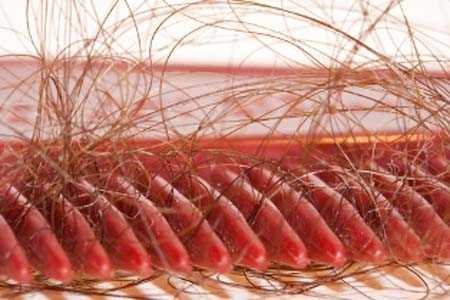 Выпадение волос при грудном вскармливании | Лечение| Ваши волосы