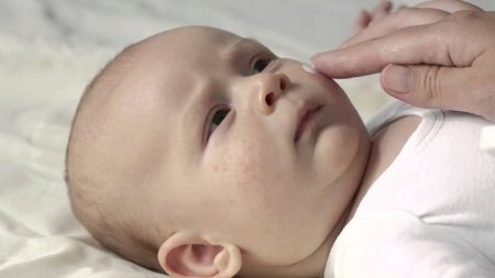 Прыщи у новорожденного на лице и голове