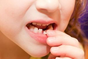 непосредственная смена молочных зубов постоянными
