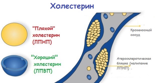 Холестерин хороший и плохой