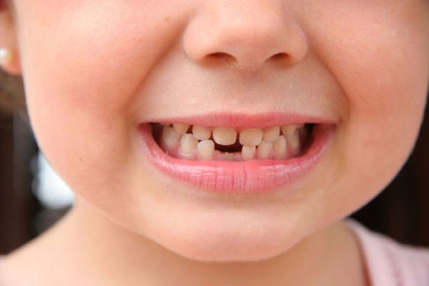 A child with a growing new tooth